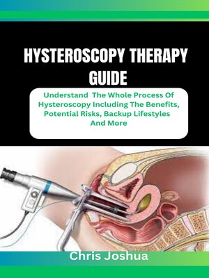 cover image of HYSTEROSCOPY THERAPY GUIDE